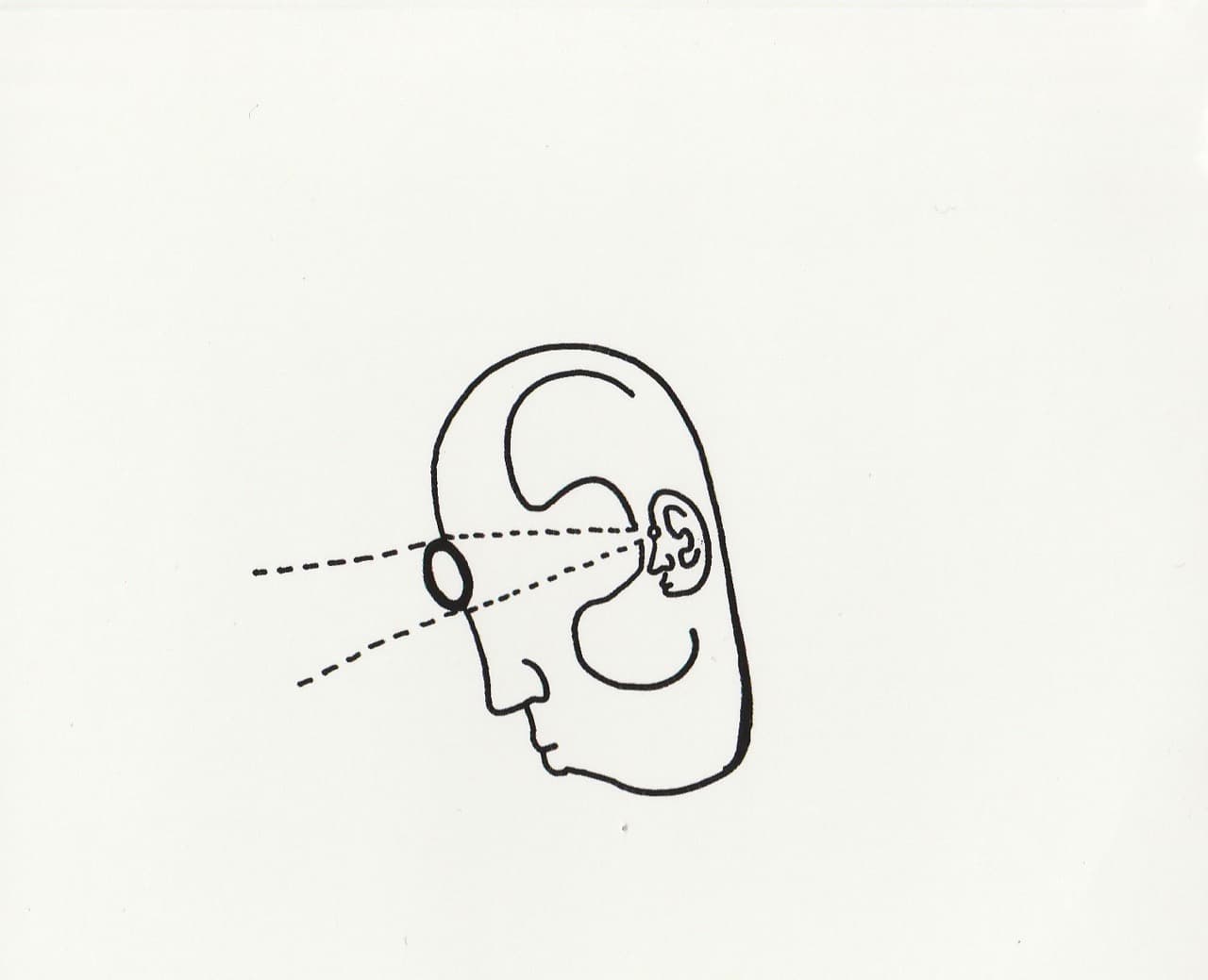 Nick Fraser – Starer